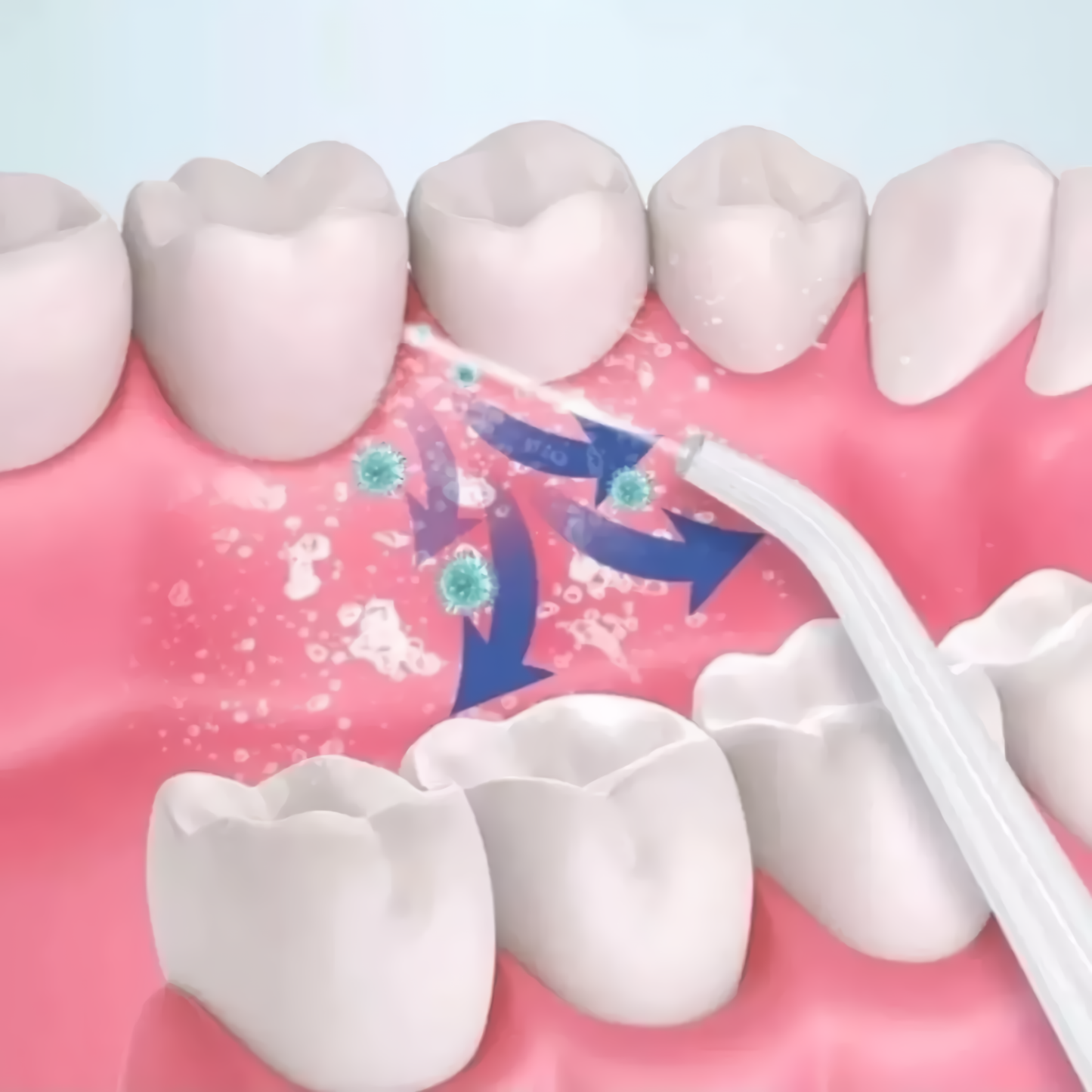 Limpiador Dental Electrico Irrigador